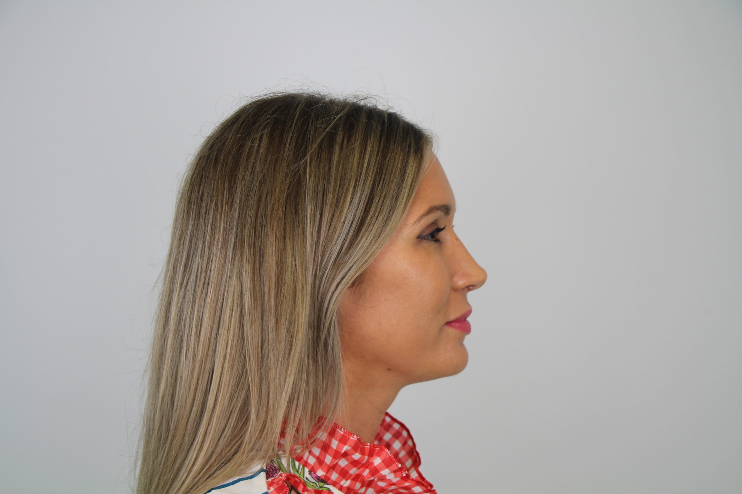 Ejemplo fotografía frontal